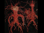 [写真] 1986, Cross Section of Cable Neuron System